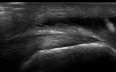 Musculoskeletal Ultrasound Training